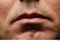  HD Face Skin Benito Romero face lips mouth scar skin pores skin texture 0002.jpg